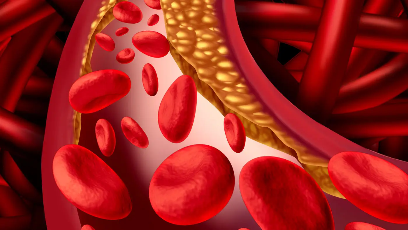 Attenzione: se noti questi tre sintomi, la tua circolazione è a rischio