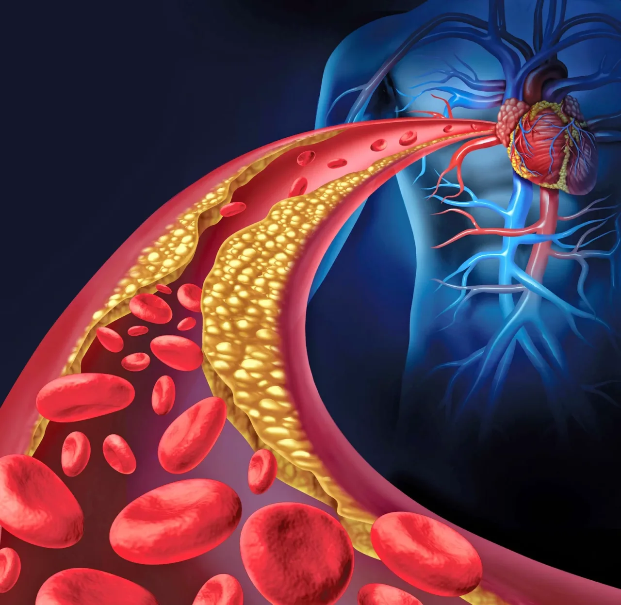 Conosci le tue arterie principali? Ecco perché è fondamentale mantenerle in salute